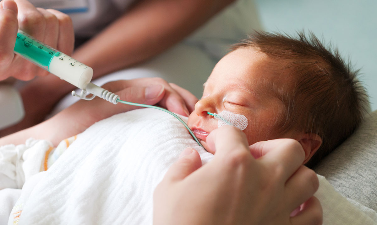 A premature baby with tubes in its nose