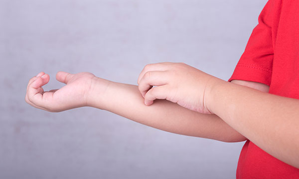 compulsive-skin-picking-in-children-istock