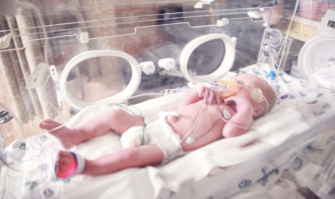 Baby in an incubator