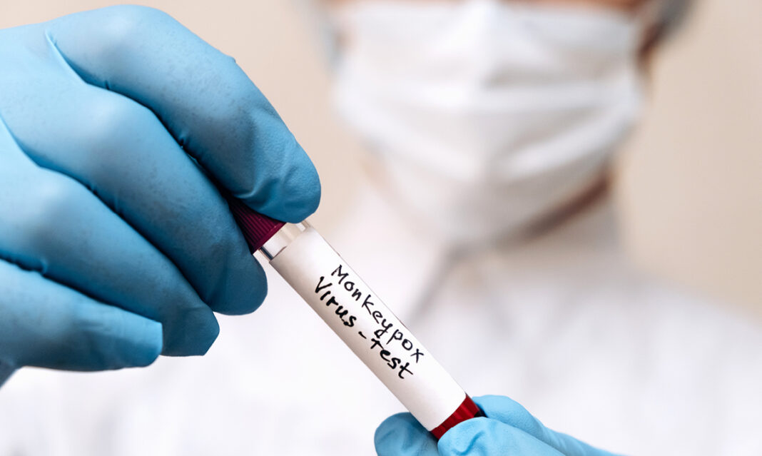 what-parents-need-to-know-about-monkeypox-istock-tatiana-buzmakova