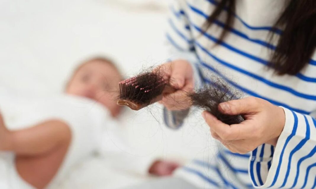 Poss partum hair loss