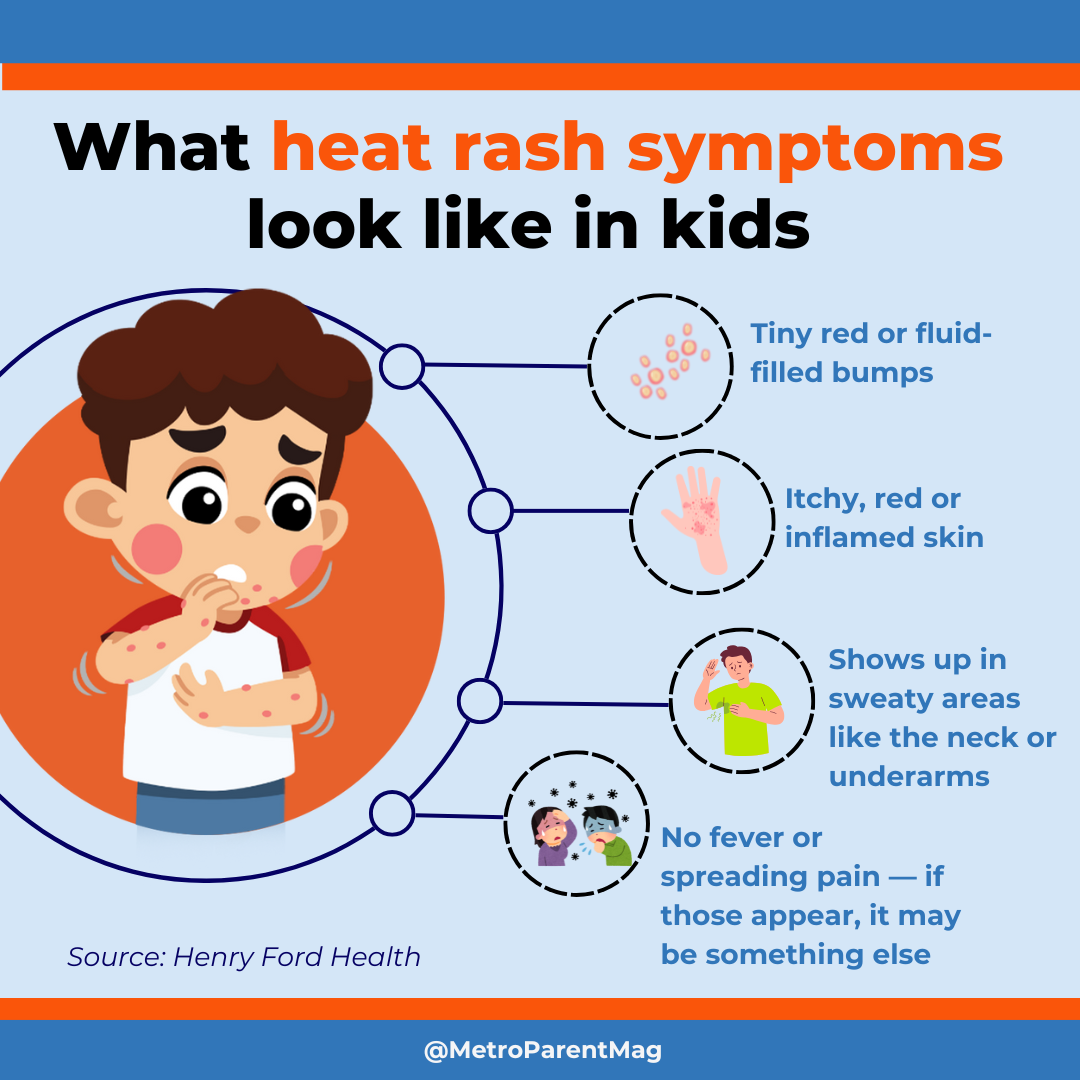 Infographic showing common heat rash symptoms in kids, including red or fluid-filled bumps, itchy skin, irritation in sweaty areas, and no fever—useful for Metro Detroit parents to identify heat rash.