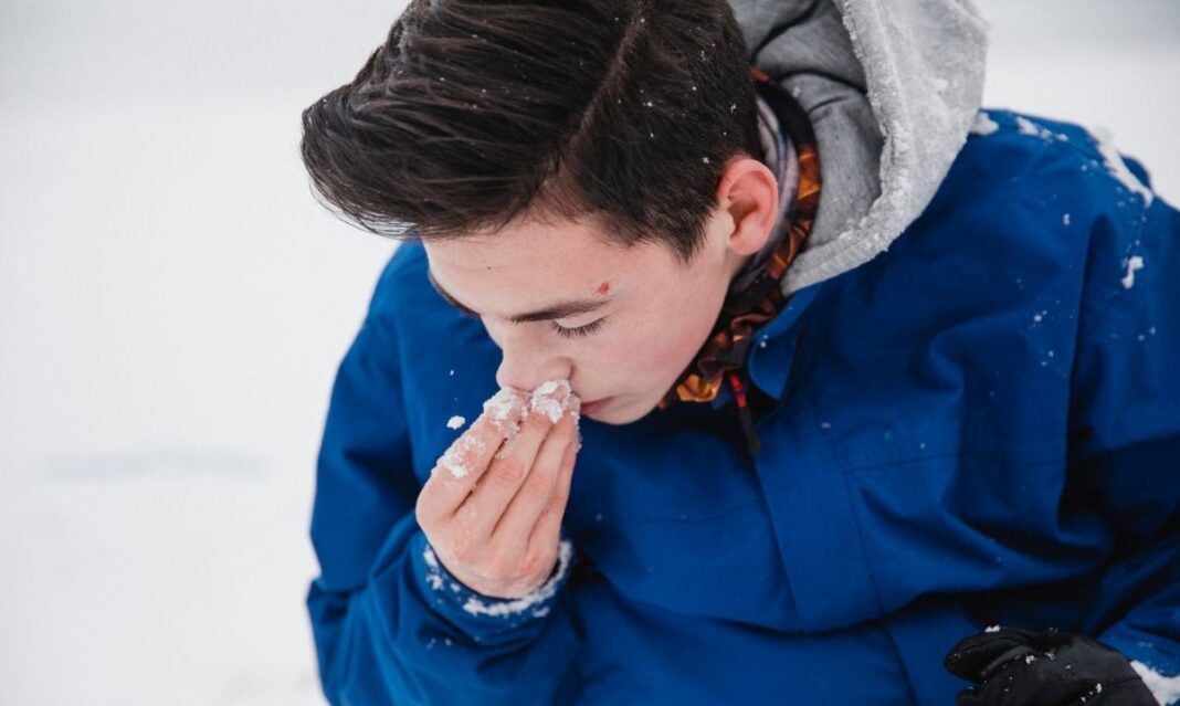 Child holding his nose after a winter nosebleed while playing in the snow highlighting how dry cold weather affects nosebleeds in kids